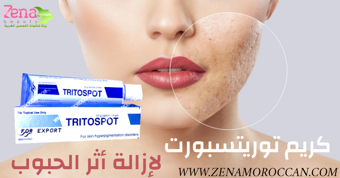 Tritospot Cream What is it? What are its benefits? And how to use it?